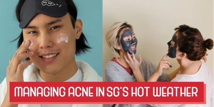 Managing Acne in Singapore Hot Weather