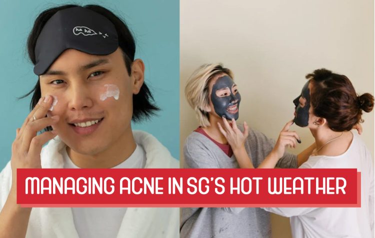 Managing Acne in Singapore Hot Weather